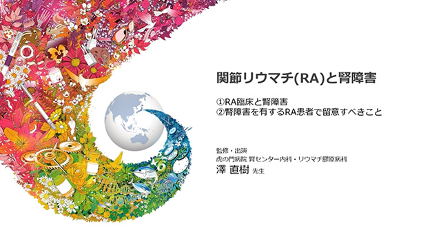 リウマチ専門医による解説動画シリーズ ”Expert of Chugai