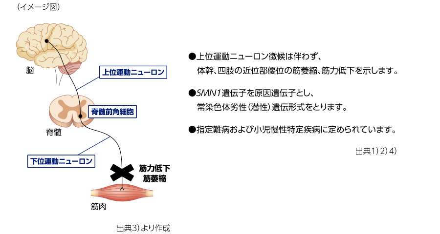 他のタイプの SMA