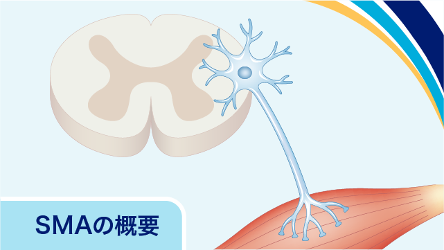 脊髄性筋萎縮症(SMA)~エブリスディ関連情報~|PLUS CHUGAI 脊髄性筋萎縮症(SMA)~エブリスディ関連情報~|PLUS CHUGAI