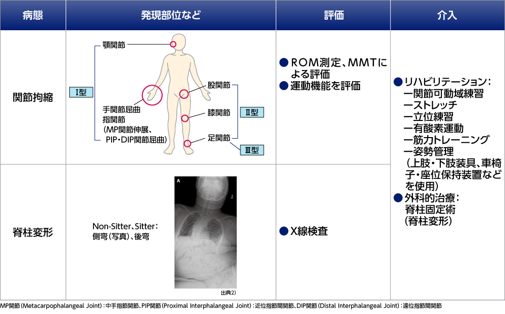 合併症の治療とケア｜PLUS CHUGAI 中外製薬医療関係者向けサイト