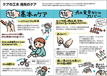 手足の症状を気にされている患者さんのケア｜PLUS CHUGAI 中外