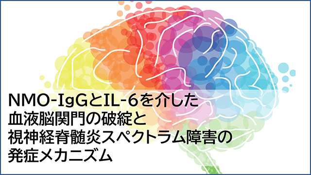 エンスプリング皮下注120mgシリンジ|PLUS CHUGAI 中外製薬医療 エンスプリング皮下注120mgシリンジ|PLUS CHUGAI 中外製薬医療