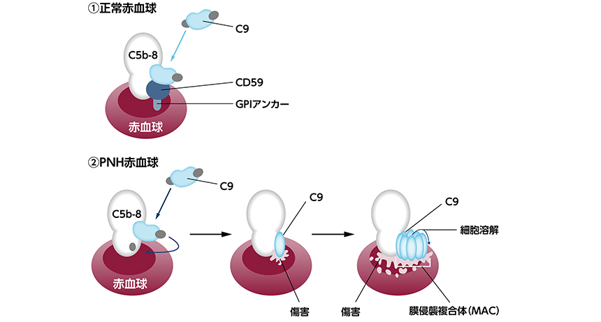 溶血のメカニズム, 補体 溶血 メカニズム – LQDG
