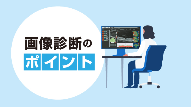 動画で学ぶ 眼科診療のスキルアップ｜PLUS CHUGAI 中外製薬医療関係者