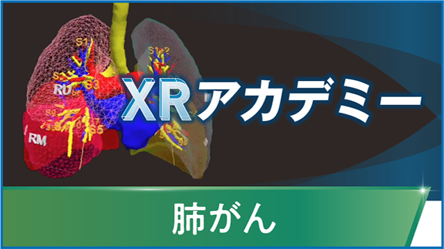 中外オンコロジー_肺がん｜PLUS CHUGAI 中外製薬医療関係者向け