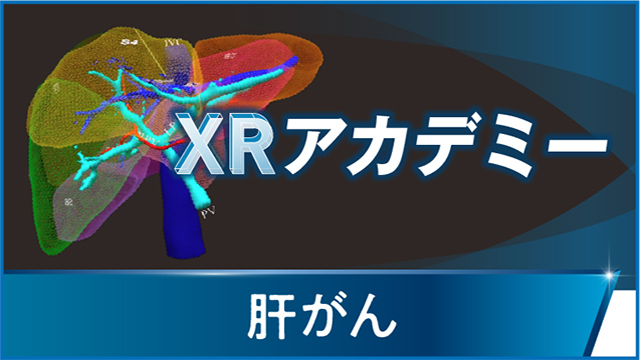 中外肝細胞癌領域情報サイト Hepatocellar cartinoma|PLUS 中外肝細胞癌領域情報サイト Hepatocellar cartinoma|PLUS