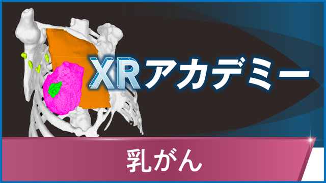 【WEB動画視聴用パスワード未使用】絹笠式TMDU大腸癌手術[Web動画付] 絹笠式TMDU大腸癌手術[Web動画付] | 絹笠祐介 |本 | 通販 | Amazon