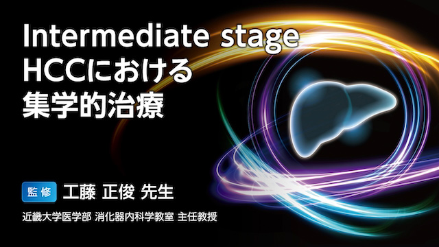 肝細胞癌治療マニュアル 若樹，山中、 亨宇，坂元; 正俊，田中 Amazon.co.jp: 肝細胞癌治療マニュアル : 田中 正俊: 本