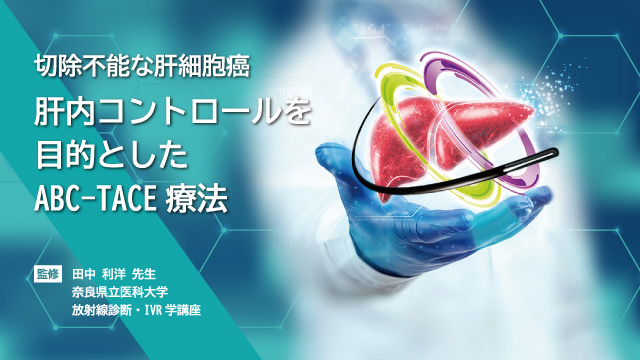 テセントリク点滴静注840mg・1200mg｜PLUS CHUGAI 中外製薬医療関係者