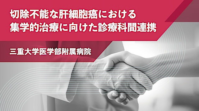 中外肝細胞癌領域情報サイト Hepatocellular carcinoma｜PLUS CHUGAI