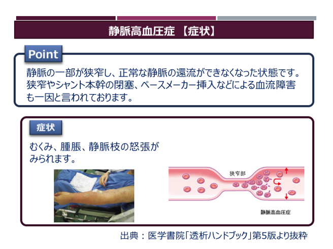 バスキュラーアクセス（シャント）｜plus Chugai 中外製薬医療関係者向けサイト（看護師・保健師向け）