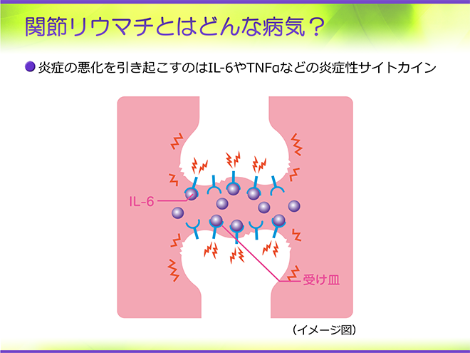 慢性関節リウマチの診断と治療ハンドブック   /メディカルレビュ-社（単行本） 関節リウマチ看護ガイドブック〜共同意思決定をめざしたトータル