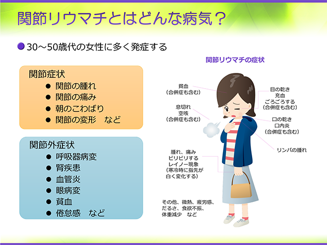 セニャレス・デ・糖尿病