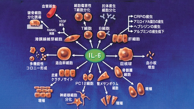 関節リウマチに対処し、より良く生きる方法を学びましょう