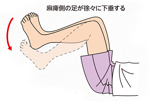 Nursing Skills｜PLUS CHUGAI 中外製薬医療関係者向けサイト（医師向け）