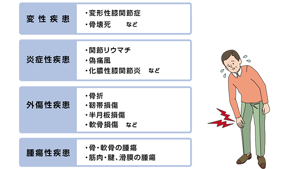 膝の痛みの原因 Plus Chugai 中外製薬医療関係者向けサイト 薬剤師向け