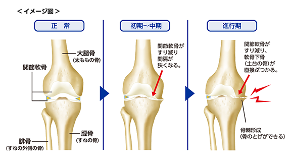 症状 Plus Chugai 中外製薬医療関係者向けサイト 薬剤師向け