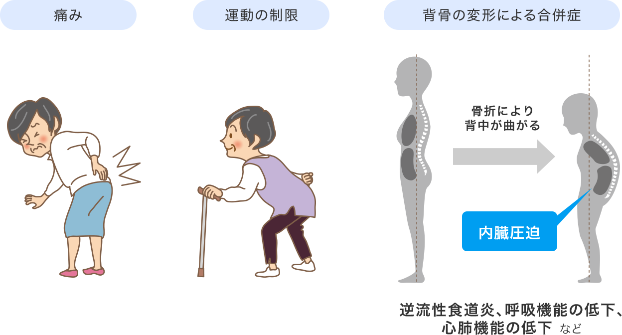 背骨の骨折が原因で現れる症状