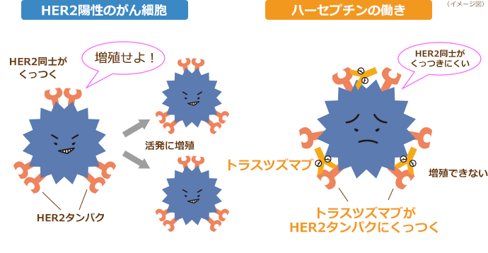 利用可能な抗HER2薬