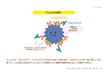 術前療法| HER2陽性乳がんインフォームドコンセントツール