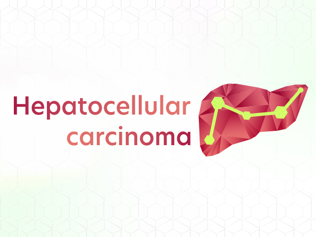 中外肝細胞癌領域情報サイト Hepatocellular carcinoma｜PLUS